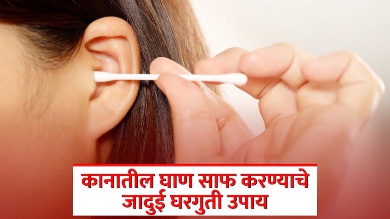 Ear Wax Removal: कान साफ करण्याचा 'हा' आहे सुरक्षित मार्ग; 5 घरगुती उपायांनी मळ होईल छू-मंतर! Ear Wax Removal: कान साफ करण्याचा 'हा' आहे सुरक्षित मार्ग; 5 घरगुती उपायांनी मळ होईल छू-मंतर!