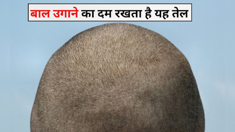 बाल चाहते हैं उगाना तो दादी का यह नुस्‍खा है रामबाण उपाय, बस चाह‍िए होंगी ये 2 चीजें