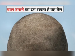 बाल चाहते हैं उगाना तो दादी का यह नुस्खा है रामबाण उपाय, बस चाहिए होंगी ये 2 चीजें बाल चाहते हैं उगाना तो दादी का यह नुस्खा है रामबाण उपाय, बस चाहिए होंगी ये 2 चीजें