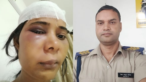 MP News: हेड कांस्टेबल बना हैवान, पत्नी को ऐसे पीटा कि बिगाड़ दिया चेहरा