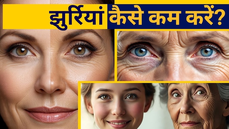 नारियल तेल में ये मिलाकर चेहर पर लगाएं, हफ्तेभर में देखें चमत्‍कार, गायब हो जाएंगी झुर्रियां