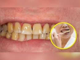पीले दांतों को सफेद कैसे करें? डॉक्टर ने बताया बस ब्रश करते हुए कर लें ये काम, ज्यादा चमकदार दिखेंगे Teeth पीले दांतों को सफेद कैसे करें? डॉक्टर ने बताया बस ब्रश करते हुए कर लें ये काम, ज्यादा चमकदार दिखेंगे Teeth
