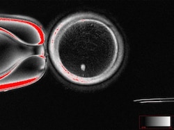 Human Skin Cells Turned Into Fertilisable Eggs For First Time