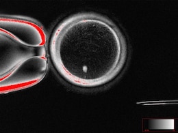 Human Skin Cells Turned Into Fertilisable Eggs For First Time