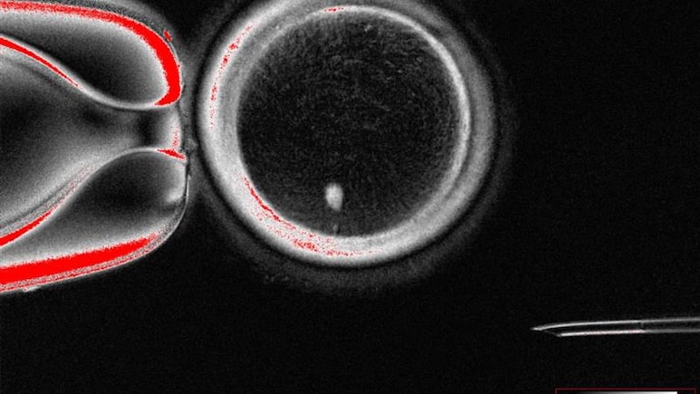 Human Skin Cells Turned Into Fertilisable Eggs For First Time