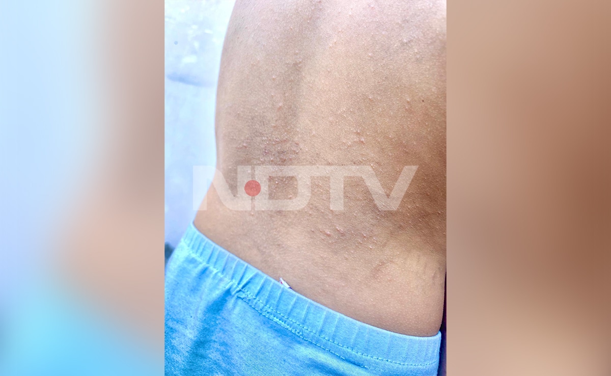 Latest and Breaking News on NDTV Latest and Breaking News on NDTV