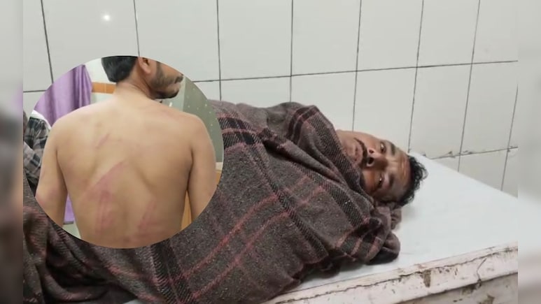 खरीदारी कर लौट रहे पिता-पुत्र को जमकर मारा-पीटा, फिर लाखों के जेवर लेकर फरार; मामले में लापरवाह दिखी पुलिस खरीदारी कर लौट रहे पिता-पुत्र को जमकर मारा-पीटा, फिर लाखों के जेवर लेकर फरार; मामले में लापरवाह दिखी पुलिस
