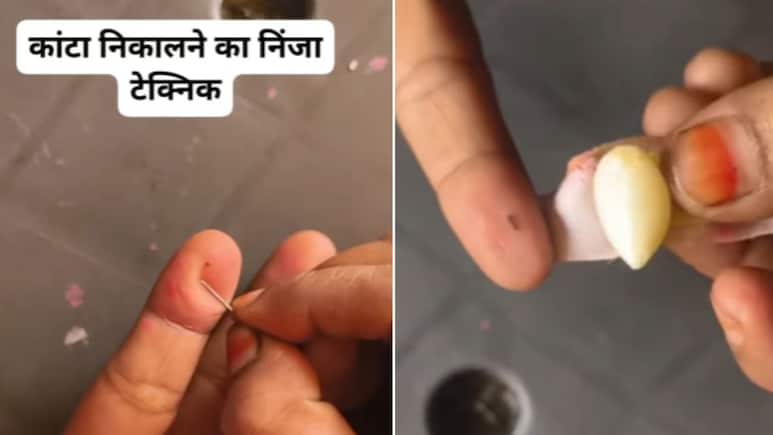 Kanta Nikalne Ki Trick: कांटा निकालने की निंजा टेक्निक, न सुई... न दर्द, झट से निकल जाएगा कांटा, जानिए कैसे Kanta Nikalne Ki Trick: कांटा निकालने की निंजा टेक्निक, न सुई... न दर्द, झट से निकल जाएगा कांटा, जानिए कैसे