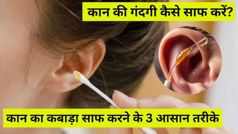 कान का कबाड़ा निकालने के लिए माचिस की तीली नहीं, ये 3 चीजें करें इस्तेमाल, खुद बाहर निकल आएगी सारी गंदगी कान का कबाड़ा निकालने के लिए माचिस की तीली नहीं, ये 3 चीजें करें इस्तेमाल, खुद बाहर निकल आएगी सारी गंदगी