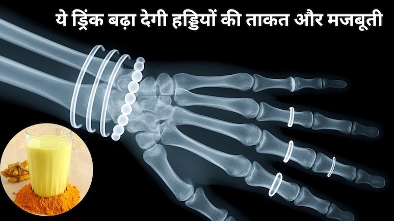गर्म दूध में मिलाएं ये मसाला, हड्डियां बनेंगी लोहे जैसी मजबूत गर्म दूध में मिलाएं ये मसाला, हड्डियां बनेंगी लोहे जैसी मजबूत
