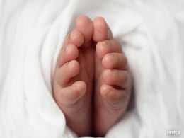 1 In 5,00,000: Newborn In Karnataka Discovered With Twin Growing Inside 1 In 5,00,000: Newborn In Karnataka Discovered With Twin Growing Inside