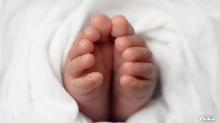 1 In 5,00,000: Newborn In Karnataka Discovered With Twin Growing Inside 1 In 5,00,000: Newborn In Karnataka Discovered With Twin Growing Inside