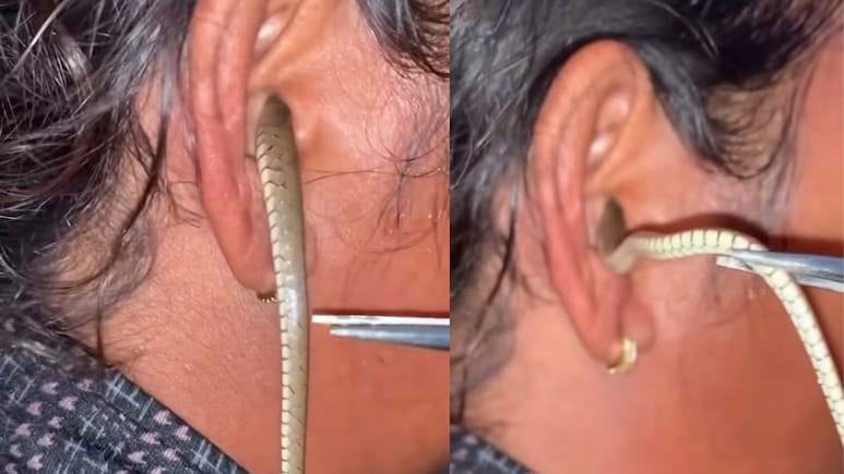 कान में सांप घुस जाए तो क्या करें? जानें कान में कीड़ा घुस जाए तो कैसे निकालें बाहर