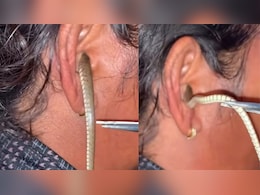 कान में सांप घुस जाए तो क्या करें? जानें कान में कीड़ा घुस जाए तो कैसे निकालें बाहर कान में सांप घुस जाए तो क्या करें? जानें कान में कीड़ा घुस जाए तो कैसे निकालें बाहर