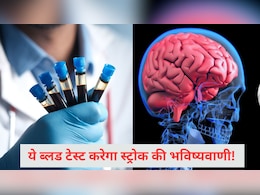 ब्लड टेस्ट जो करता है स्ट्रोक की भविष्यवाणी, इस संकेत को पहचान लगा सकते हैं Stroke का पता ब्लड टेस्ट जो करता है स्ट्रोक की भविष्यवाणी, इस संकेत को पहचान लगा सकते हैं Stroke का पता
