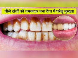 पीले दांत नॉर्मल टूथपेस्ट से नहीं हो रहे साफ, तो बेकिंग सोडा के इस घरेलू नुस्खे को आजमाएं, फिर देखें कमाल पीले दांत नॉर्मल टूथपेस्ट से नहीं हो रहे साफ, तो बेकिंग सोडा के इस घरेलू नुस्खे को आजमाएं, फिर देखें कमाल