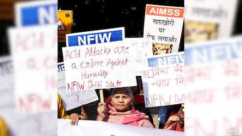 20-Year-Old Woman Suffers Burn Injuries In Acid Attack In Delhi 20-Year-Old Woman Suffers Burn Injuries In Acid Attack In Delhi