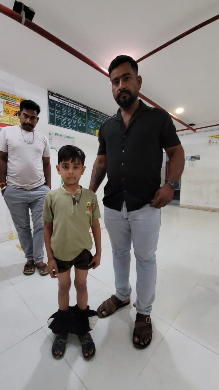 मासूम के कपड़े के अंदर दिखे पिटाई के निशान मासूम के कपड़े के अंदर दिखे पिटाई के निशान