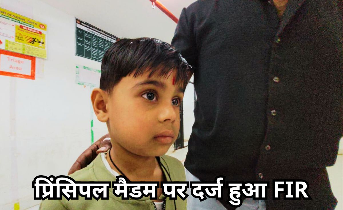 प्रिंसिपल मैडम की हैवानियत! पहाड़ा नहीं सुना पाया तो मासूम को लोहे के रॉड से पीटा, घाव देख सहम गए परिजन