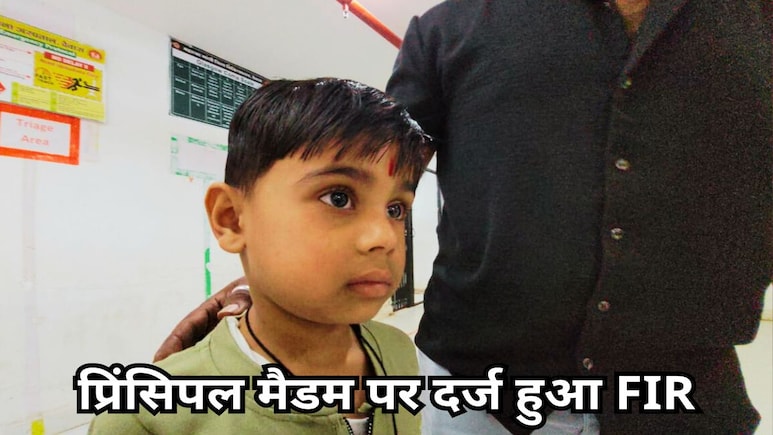 प्रिंसिपल मैडम की हैवानियत! पहाड़ा नहीं सुना पाया तो मासूम को लोहे के रॉड से पीटा, घाव देख सहम गए परिजन प्रिंसिपल मैडम की हैवानियत! पहाड़ा नहीं सुना पाया तो मासूम को लोहे के रॉड से पीटा, घाव देख सहम गए परिजन