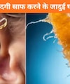 कान का कबाड़ा कैसे निकालें? ये 5 घरेलू तरीके आएंगे काम, अपने आप निकलने लगेगी कान की गंदगी