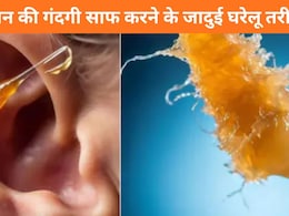 कान का कबाड़ा कैसे निकालें? ये 5 घरेलू तरीके आएंगे काम, अपने आप निकलने लगेगी कान की गंदगी कान का कबाड़ा कैसे निकालें? ये 5 घरेलू तरीके आएंगे काम, अपने आप निकलने लगेगी कान की गंदगी