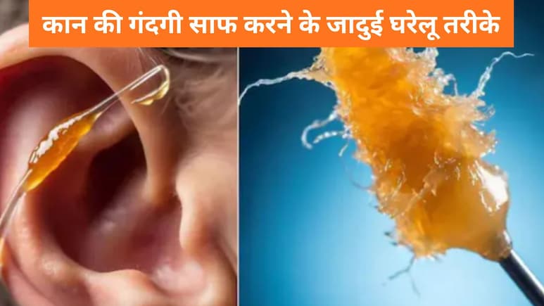 कान का कबाड़ा कैसे निकालें? ये 5 घरेलू तरीके आएंगे काम, अपने आप निकलने लगेगी कान की गंदगी कान का कबाड़ा कैसे निकालें? ये 5 घरेलू तरीके आएंगे काम, अपने आप निकलने लगेगी कान की गंदगी
