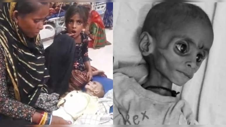 सूखे बच्चे, 10 लाख भूखे, सिस्टम चुप, MP के इन तीन जिलों की चुप्पी कोई सुनेगा? सूखे बच्चे, 10 लाख भूखे, सिस्टम चुप, MP के इन तीन जिलों की चुप्पी कोई सुनेगा?