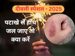 Diwali 2025 : हल्का जलने पर इस तरह करें घर में इलाज, यहां जानें जलन कम करने और इन्फेक्शन रोकने के आसान टिप्स