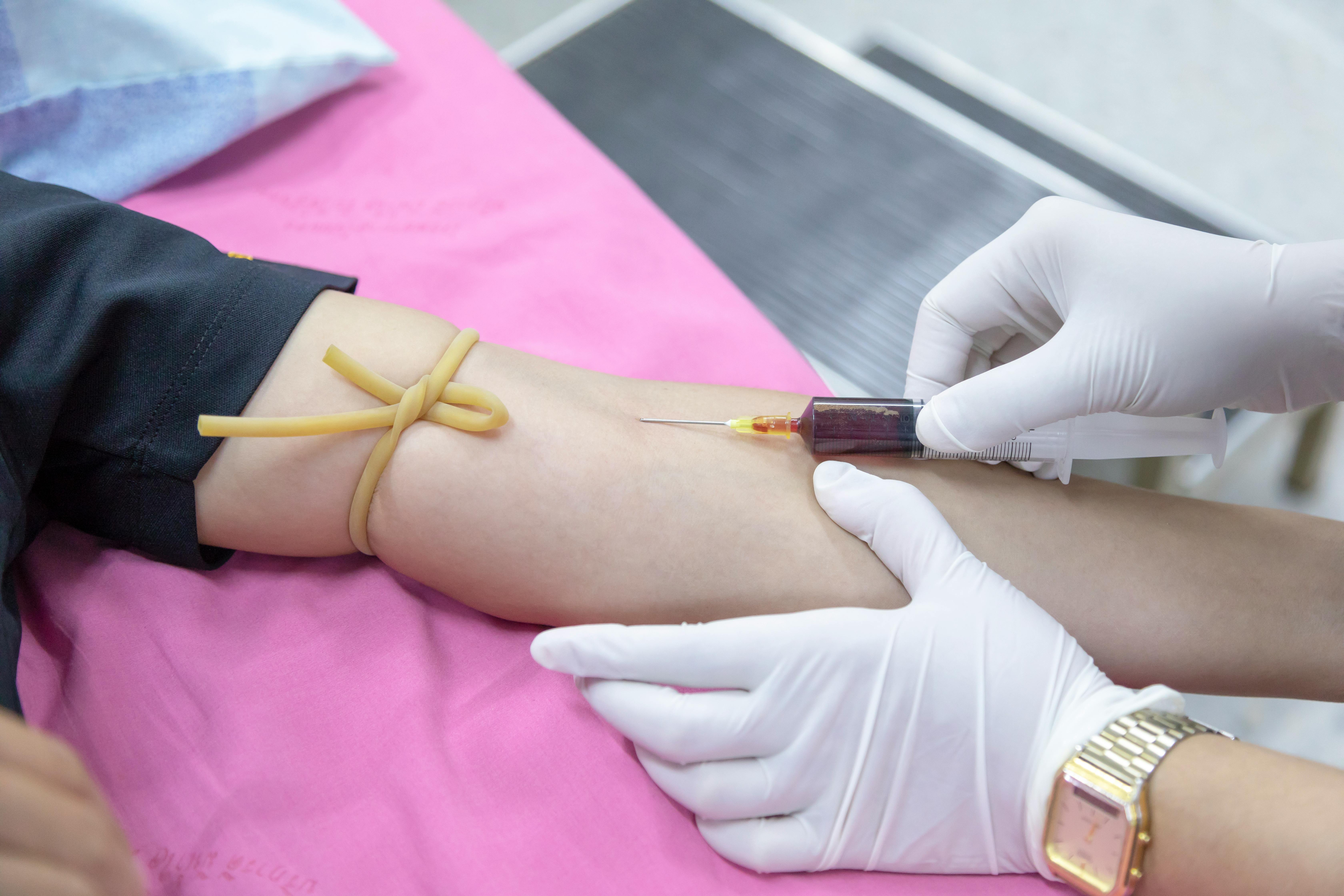 New Blood Test Can Detect Head And Neck Cancer 10 Years Early
