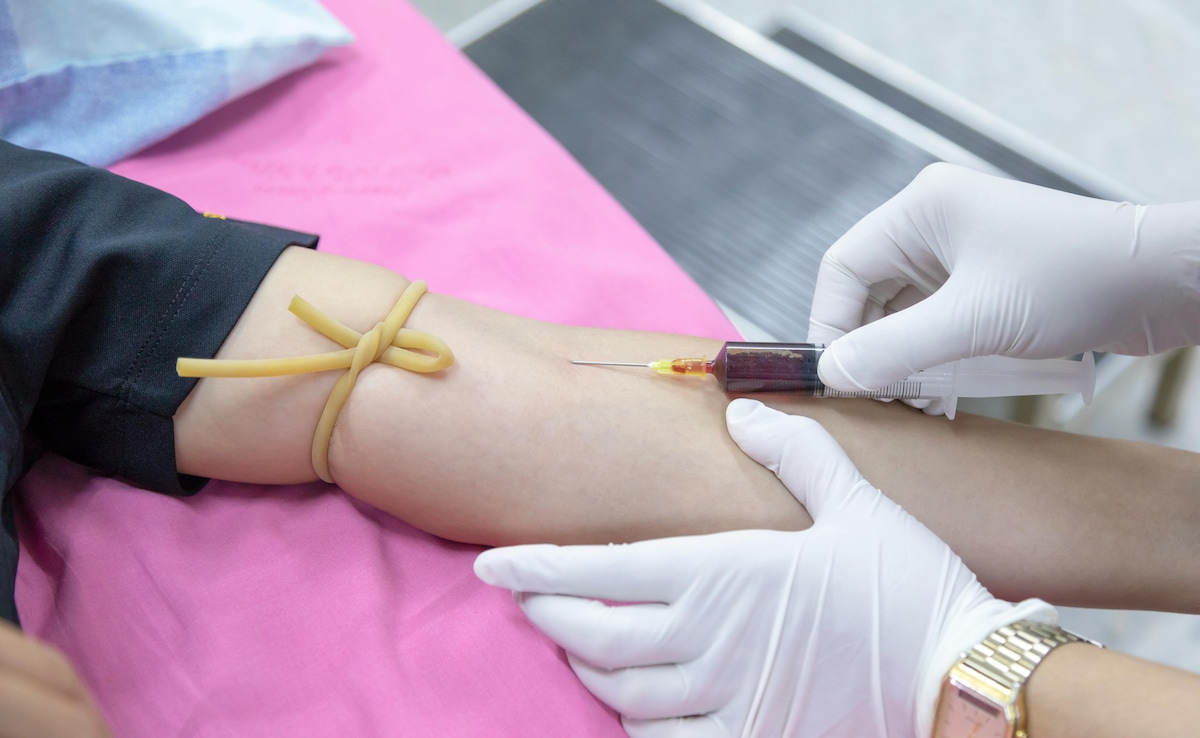 The Art of Baking: From Classic Bread to Artisan Pastries