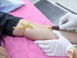 New Blood Test Can Detect Head And Neck Cancer 10 Years Early