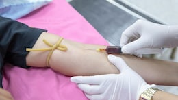 Nutritionist Highlights How The TyG Index Can Reveal Hidden Risk Of Insulin Resistance