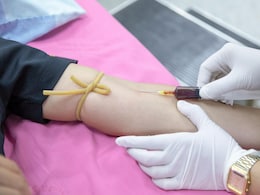 New Blood Test Can Detect Head And Neck Cancer 10 Years Early New Blood Test Can Detect Head And Neck Cancer 10 Years Early