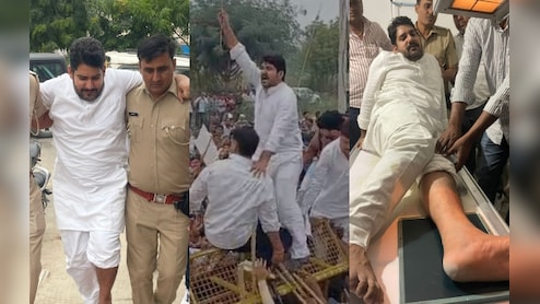 Didwana: ज़मीनों को सरकारी संरक्षण में लेने का विरोध, प्रदर्शन के दौरान MLA मुकेश भाकर का पैर फ्रैक्चर 