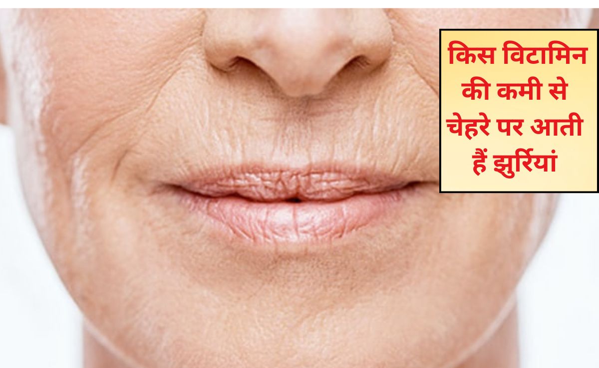 क‍िस व‍िटाम‍िन की कमी से चेहरे पर आती हैं झुर्रियां? झुर्रियां खत्म करने के लिए क्या खाएं? जान‍िए यहां पर