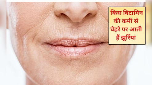 क‍िस व‍िटाम‍िन की कमी से चेहरे पर आती हैं झुर्रियां? झुर्रियां खत्म करने के लिए क्या खाएं? जान‍िए यहां पर
