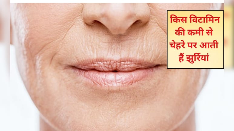 किस विटामिन की कमी से चेहरे पर आती हैं झुर्रियां? झुर्रियां खत्म करने के लिए क्या खाएं? जानिए यहां पर किस विटामिन की कमी से चेहरे पर आती हैं झुर्रियां? झुर्रियां खत्म करने के लिए क्या खाएं? जानिए यहां पर