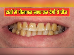 आयुर्वेदिक डॉक्टर ने बताया दांतों को चमकाने का 1400 साल पुराना नुस्खा, जानें पीले दांतों को सफेद करने के लिए क्या करें आयुर्वेदिक डॉक्टर ने बताया दांतों को चमकाने का 1400 साल पुराना नुस्खा, जानें पीले दांतों को सफेद करने के लिए क्या करें