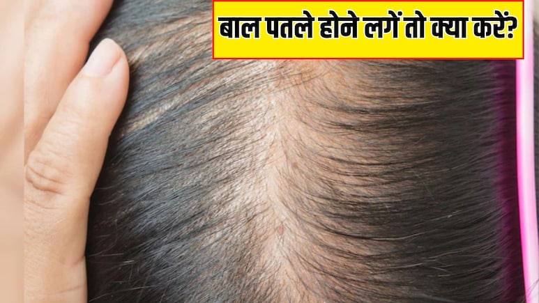 सिर से क्यों पतले हो जाते हैं बाल? आयुर्वेदिक न्यूट्रिशनिस्ट ने बताया स्कैल्प दिखने लगे तो कर लें ये काम