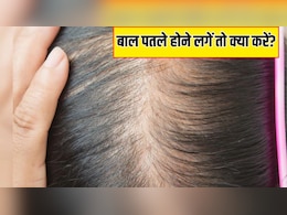 सिर से क्यों पतले हो जाते हैं बाल? आयुर्वेदिक न्यूट्रिशनिस्ट ने बताया स्कैल्प दिखने लगे तो कर लें ये काम सिर से क्यों पतले हो जाते हैं बाल? आयुर्वेदिक न्यूट्रिशनिस्ट ने बताया स्कैल्प दिखने लगे तो कर लें ये काम
