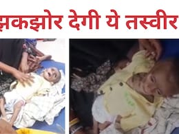 मासूम की हड्डियों से चिपक गई चमड़ी, कुपोषण की ऐसी मार कि रोने पर आवाज भी नहीं निकलती  मासूम की हड्डियों से चिपक गई चमड़ी, कुपोषण की ऐसी मार कि रोने पर आवाज भी नहीं निकलती