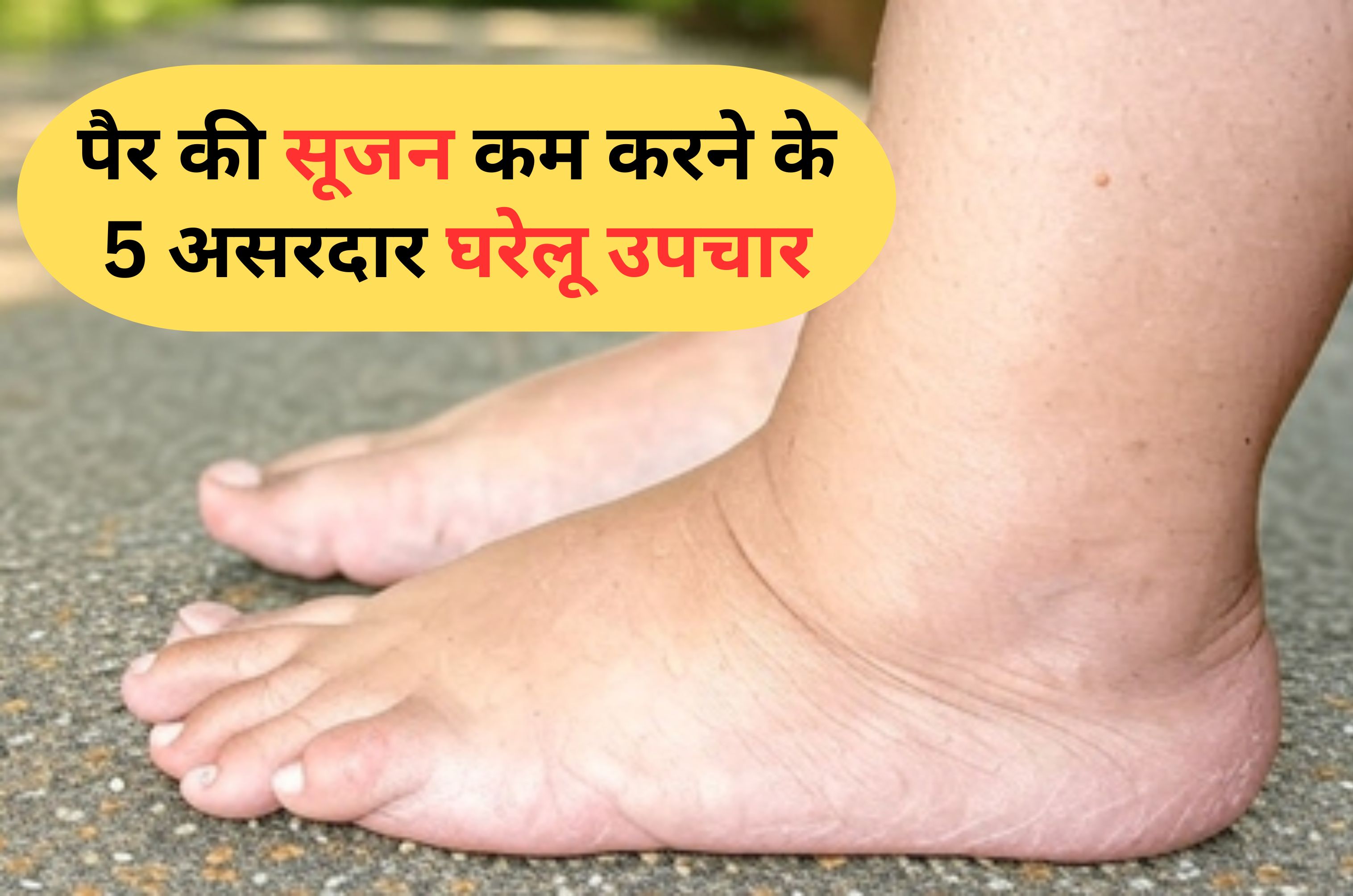 घरेलू नुस्खा: लंबे समय तक खड़े रहने या बैठने से सूज जाते हैं पैर? इस नैचुरल तरीके से तुरंत Swelling होगी कम