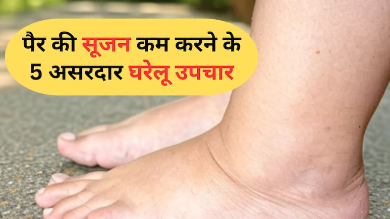 घरेलू नुस्खा: लंबे समय तक खड़े रहने या बैठने से सूज जाते हैं पैर? इस नैचुरल तरीके से तुरंत Swelling होगी कम घरेलू नुस्खा: लंबे समय तक खड़े रहने या बैठने से सूज जाते हैं पैर? इस नैचुरल तरीके से तुरंत Swelling होगी कम