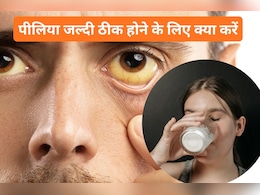 क्या पीलिया में दूध पी सकते हैं? जानें इस रोग से जुड़े ऐसे 8 सवालों के जवाब क्या पीलिया में दूध पी सकते हैं? जानें इस रोग से जुड़े ऐसे 8 सवालों के जवाब