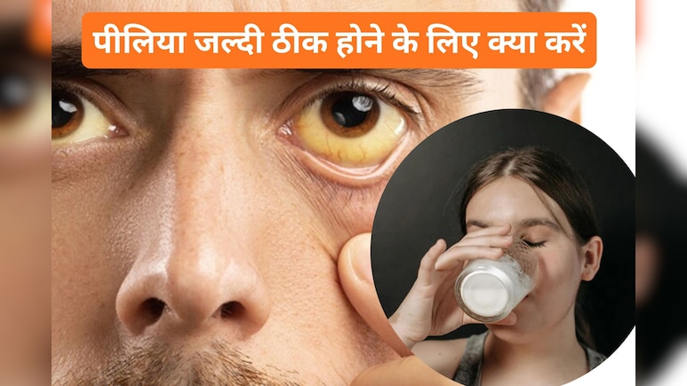 क्या पीलिया में दूध पी सकते हैं? जानें इस रोग से जुड़े ऐसे 8 सवालों के जवाब क्या पीलिया में दूध पी सकते हैं? जानें इस रोग से जुड़े ऐसे 8 सवालों के जवाब