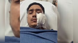 Gwalior Shooting Incident: भाई ने भाई पर चलाई गोली, वह तो बच गया लेकिन दोस्त को जा लगी