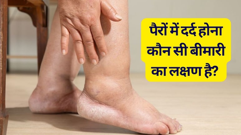 पैरों में दर्द क्यों होता है? बिना वजह पैरों में दर्द क्यों होता है? जान लें क‍िस बीमार का हो सकता है लक्षण