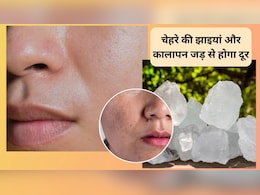 ये 5 रुपये का पत्थर चेहरे की झाइयां, कालापन और झुर्रियां जड़ से करेगा खत्म, एक्सपर्ट से जानिए इसके जादुई फायदे ये 5 रुपये का पत्थर चेहरे की झाइयां, कालापन और झुर्रियां जड़ से करेगा खत्म, एक्सपर्ट से जानिए इसके जादुई फायदे