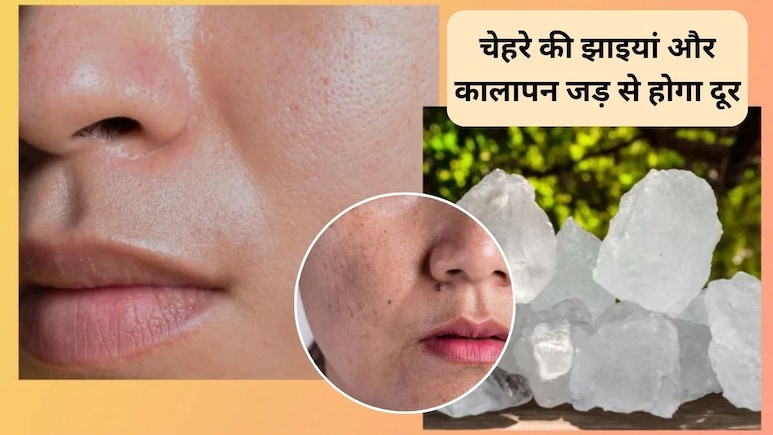 ये 5 रुपये का पत्थर चेहरे की झाइयां, कालापन और झुर्रियां जड़ से करेगा खत्म, एक्सपर्ट से जानिए इसके जादुई फायदे ये 5 रुपये का पत्थर चेहरे की झाइयां, कालापन और झुर्रियां जड़ से करेगा खत्म, एक्सपर्ट से जानिए इसके जादुई फायदे